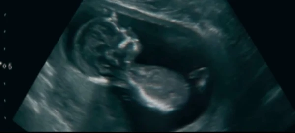 Lauana Prado anunciou gravidez por Reprodução/Instagram