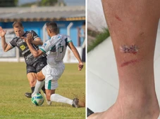 Imagem - Ex-Bahia ganha prêmio de melhor em campo após marcar gol com corte profundo na perna