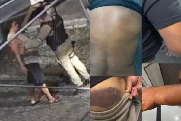 Perdigão denúnciou agressão sofrida por PM