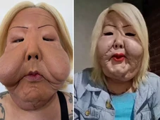 Imagem - Juju do Pix coloca 550 ml de silicone, mostra resultado e comemora: ‘Estou amando’