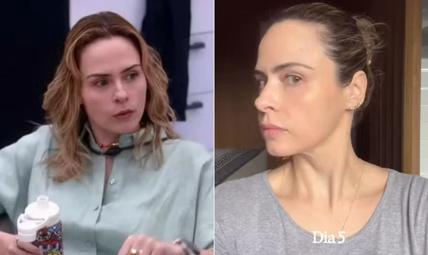 Ana Paula fez procedimentos estéticos no rosto um mês antes de entrar no 'BBB 26' por Reprodução/Redes Sociais 