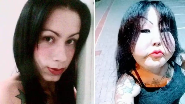 Juju do Pix antes e depois das cirurgias clandestinas por Reprodução/Redes Sociais 