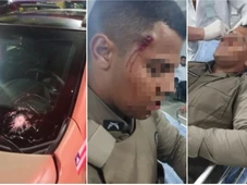 Imagem - Policial fica ferido após ataque a tiros contra viatura no Nordeste de Amaralina