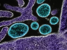 Imagem - Nipah: vírus com alto índice de mortalidade causa surto e quarentena na Ásia