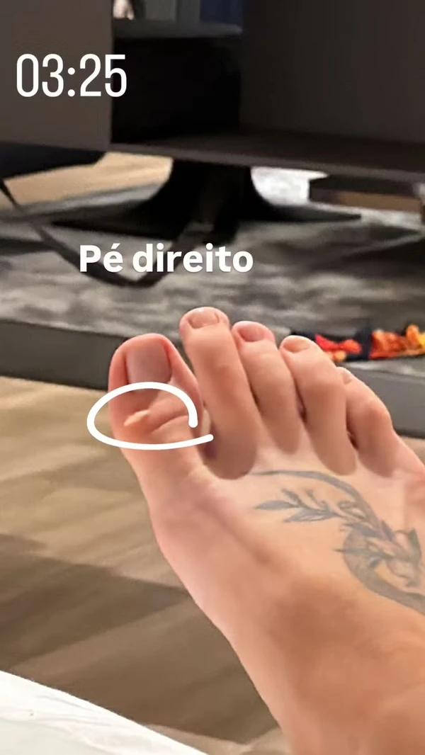 Virginia exibe galo na testa e machucados após ensaio da Grande Rio por Reprodução/Redes Sociais 