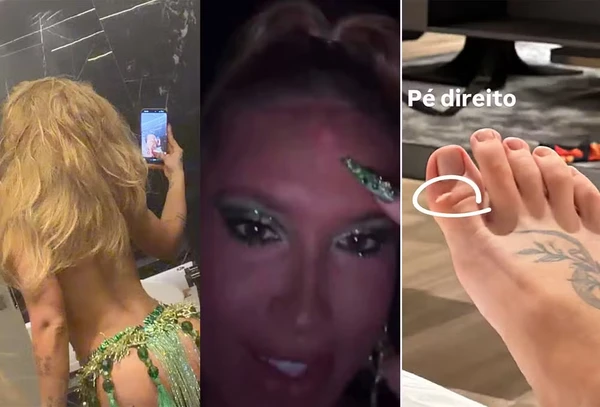 Virginia exibe galo na testa e machucados após ensaio da Grande Rio por Reprodução/Redes Sociais 