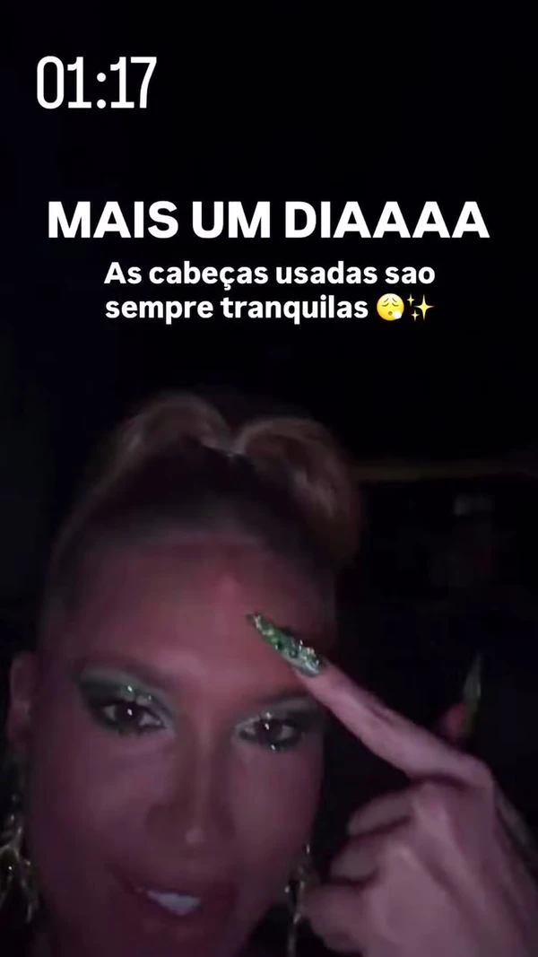 Virginia exibe galo na testa e machucados após ensaio da Grande Rio por Reprodução/Redes Sociais 