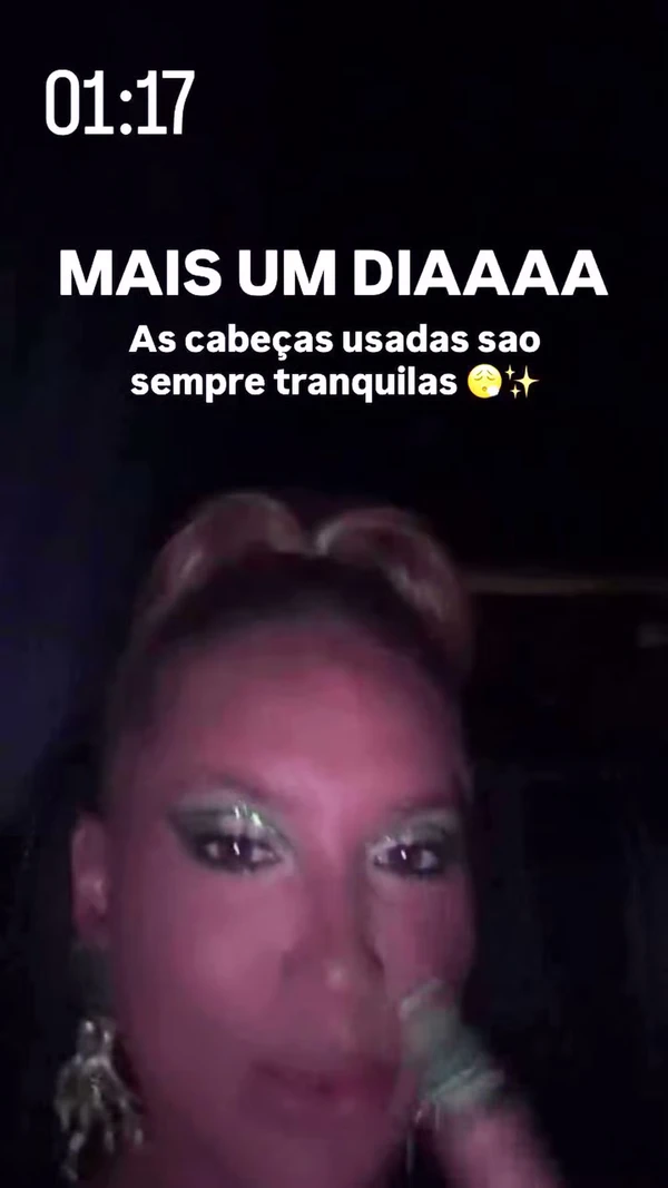 Virginia exibe galo na testa e machucados após ensaio da Grande Rio por Reprodução/Redes Sociais 