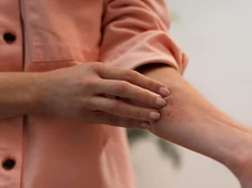 Imagem - Não é coincidência: por que cicatrizes coçam ou doem antes da chuva