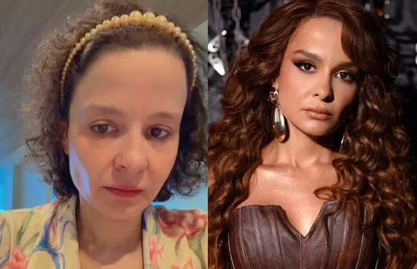 Maiara, dupla de Maraisa, relata trauma com a queda de cabelo por Reprodução/Redes Sociais 