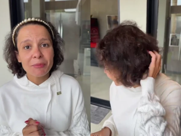 Maiara, dupla de Maraisa, relata trauma com a queda de cabelo