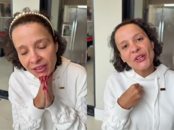 Maiara, dupla de Maraisa, relata trauma com a queda de cabelo por Reprodução/Redes Sociais 