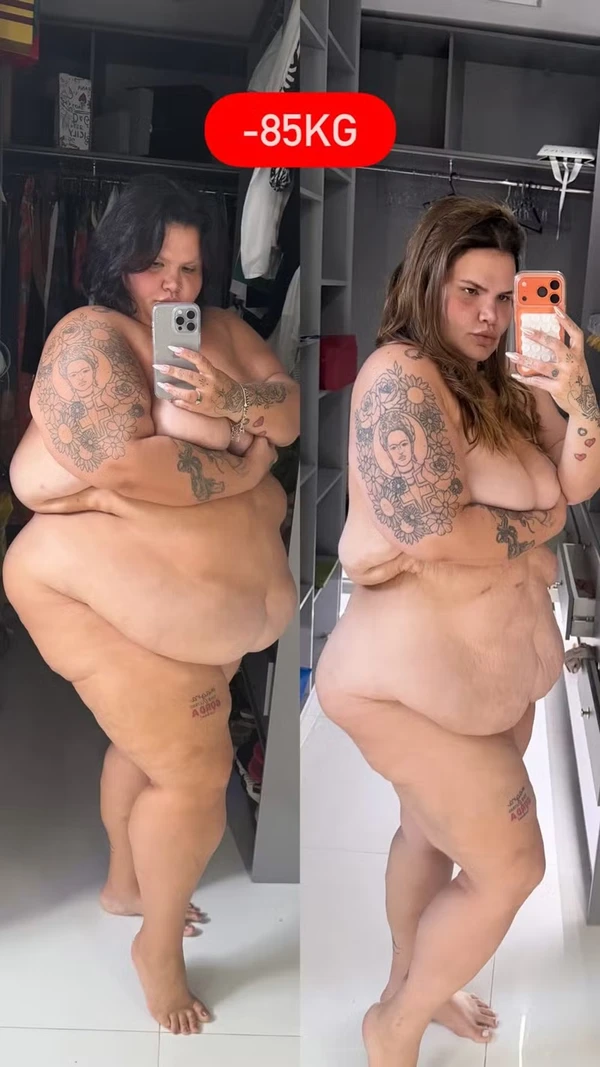 Thais Carla mostra antes e depois do corpo após perder 85 kg por Reprodução/Redes Sociais 