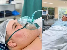 Imagem - Gordão da XJ retira pedras na vesícula e choca com quantidade: 'Dava para construir uma casa'