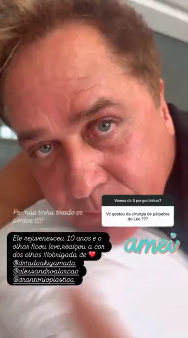 Esposa de Leonardo exibiu resultado nas redes sociais