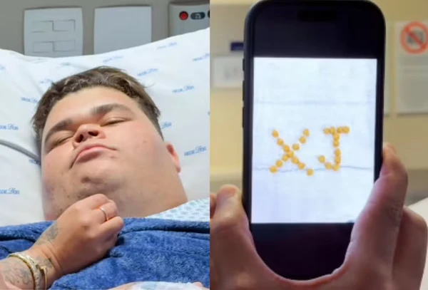 Gordão da XJ faz cirurgia para tirar pedras na vesícula por Reprodução/Redes Sociais 