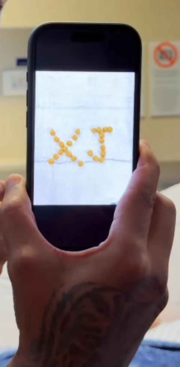 Gordão da XJ faz cirurgia para tirar pedras na vesícula por Reprodução/Redes Sociais 