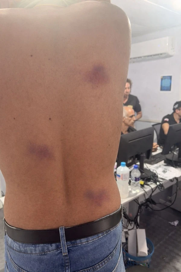 Esposo de alun-oficial da PM foi alvo de agressões por Acervo pessoal