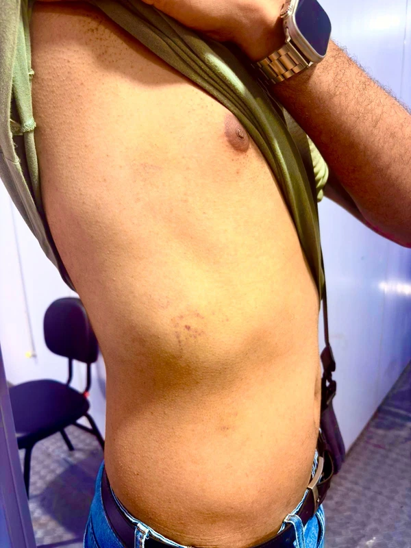 Esposo de alun-oficial da PM foi alvo de agressões por Acervo pessoal