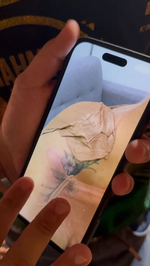 Lucas Guedez mostra hematomas de Virginia Fonseca por Reprodução/Instagram