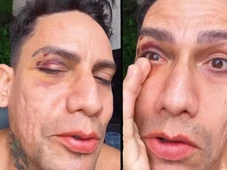 Imagem - Arquiteto é agredido por grupo de jovens após se vestir como drag queen no Carnaval: 'Levei um soco'