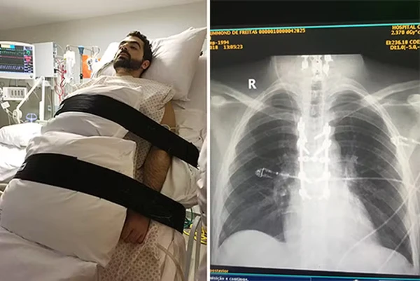 Bruno sofreu acidente em 2018 por Reprodução