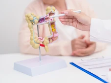 Imagem - O que aumenta o risco de câncer colorretal, doença que aumenta entre jovens