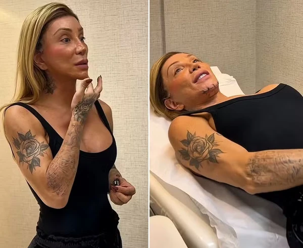 Maya Massafera faz cirurgia para afinar o queixo por Reprodução/Instagram