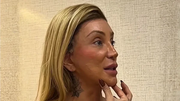 Maya Massafera faz cirurgia para afinar o queixo 