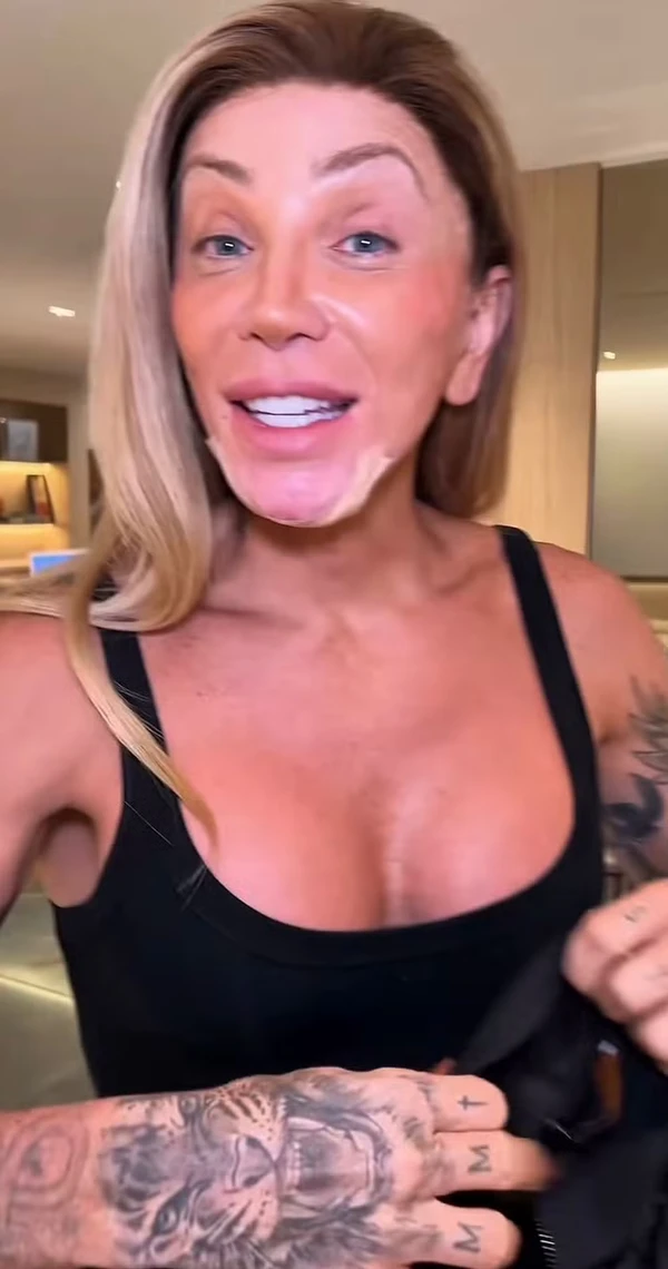 Maya Massafera faz cirurgia para afinar o queixo por Reprodução/Instagram