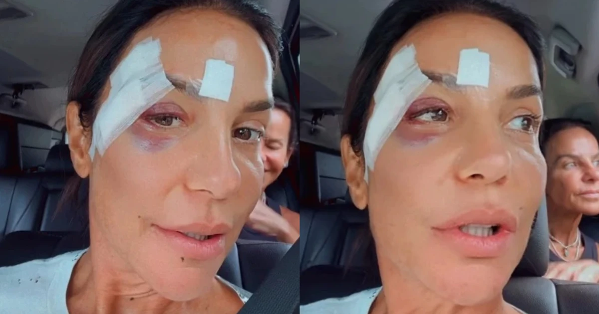 Imagem - Com rosto machucado, Ivete Sangalo volta ao hospital e passa por cirurgia