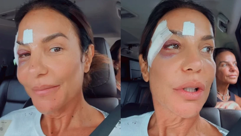 Imagem - Entenda doença que fez Ivete Sangalo 'apagar' e cair no banheiro