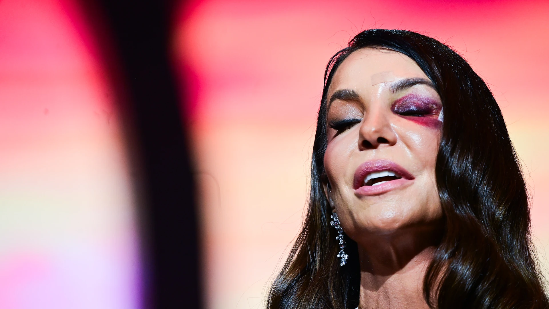 Imagem - Ivete Sangalo detalha acidente doméstico após desmaio e ida ao hospital: 'Caí e bati a cabeça no chão'