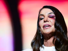 Imagem - Ivete Sangalo detalha acidente doméstico após desmaio e ida ao hospital: 'Caí e bati a cabeça no chão'