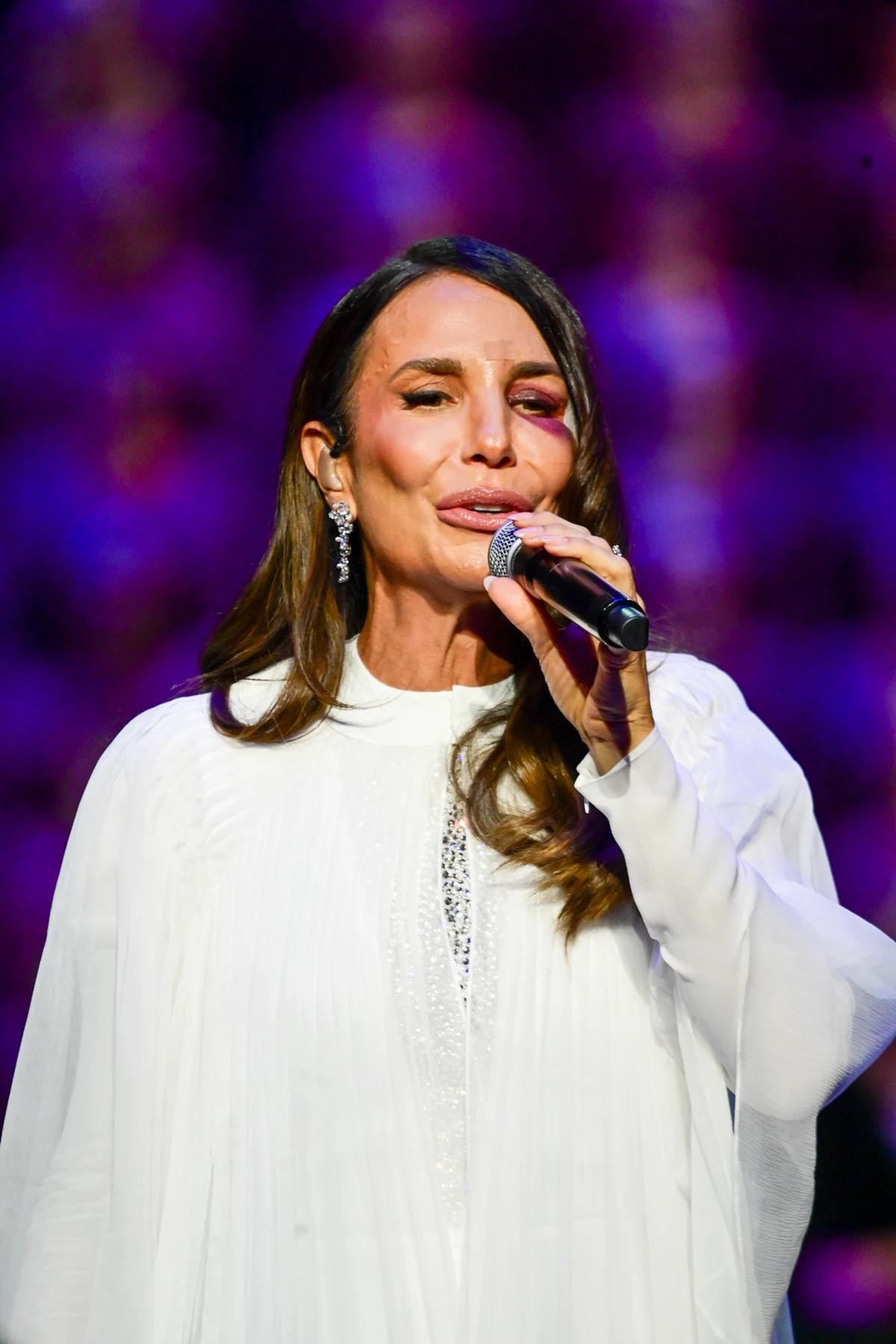 Ivete Sangalo faz primeiro show após acidente doméstico por Léo Franco/AgNews