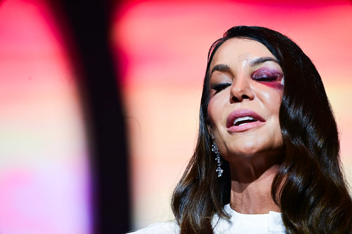 Ivete Sangalo faz primeiro show após acidente doméstico