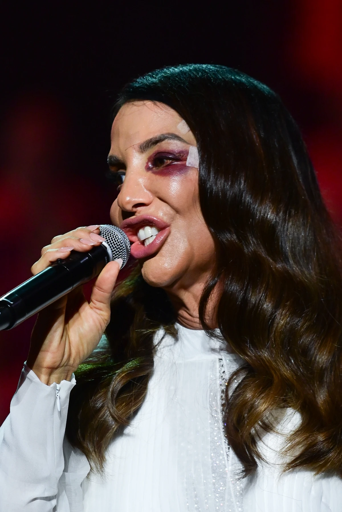 Ivete Sangalo faz primeiro show após acidente doméstico por Léo Franco/AgNews