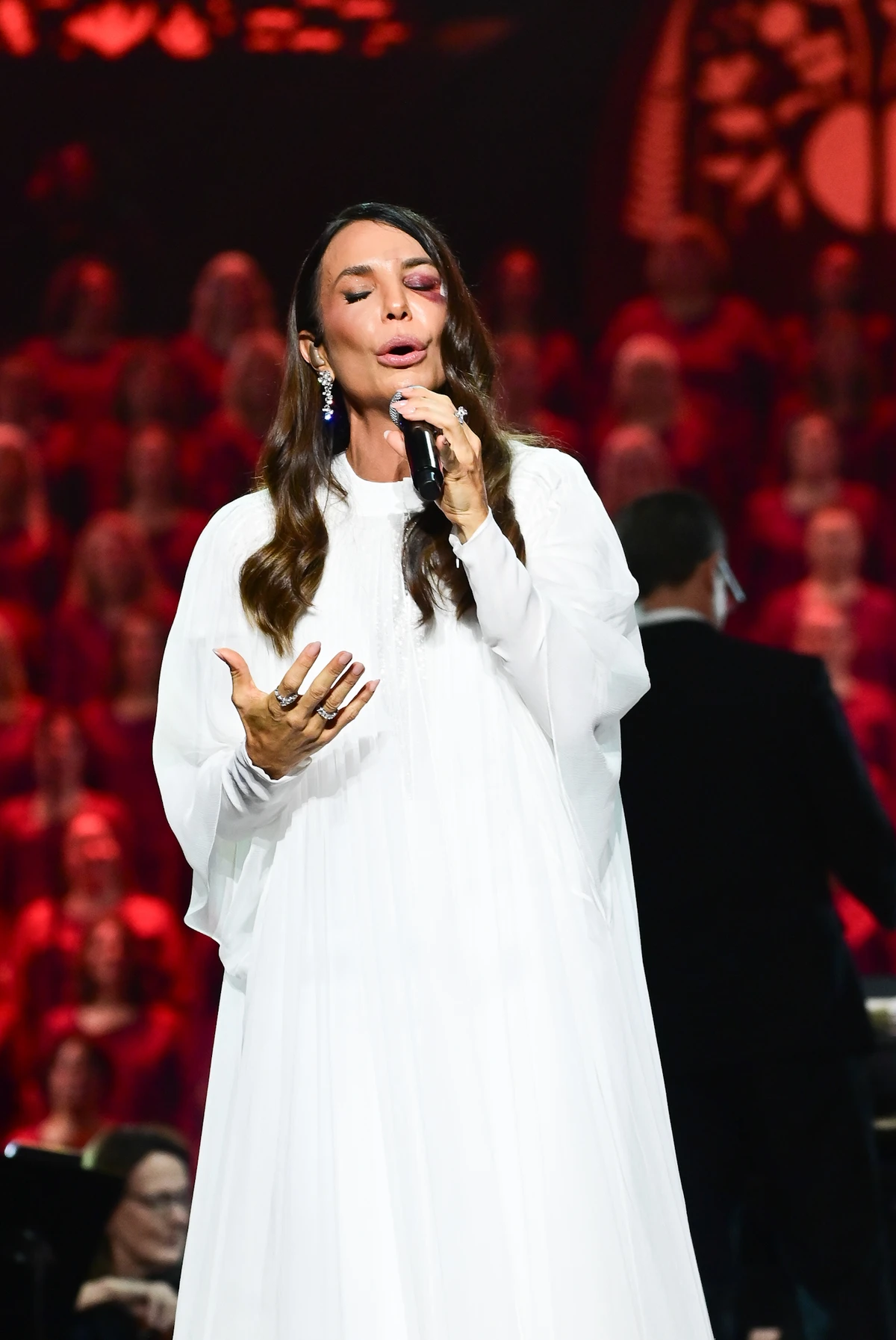 Ivete Sangalo faz primeiro show após acidente doméstico por Léo Franco/AgNews