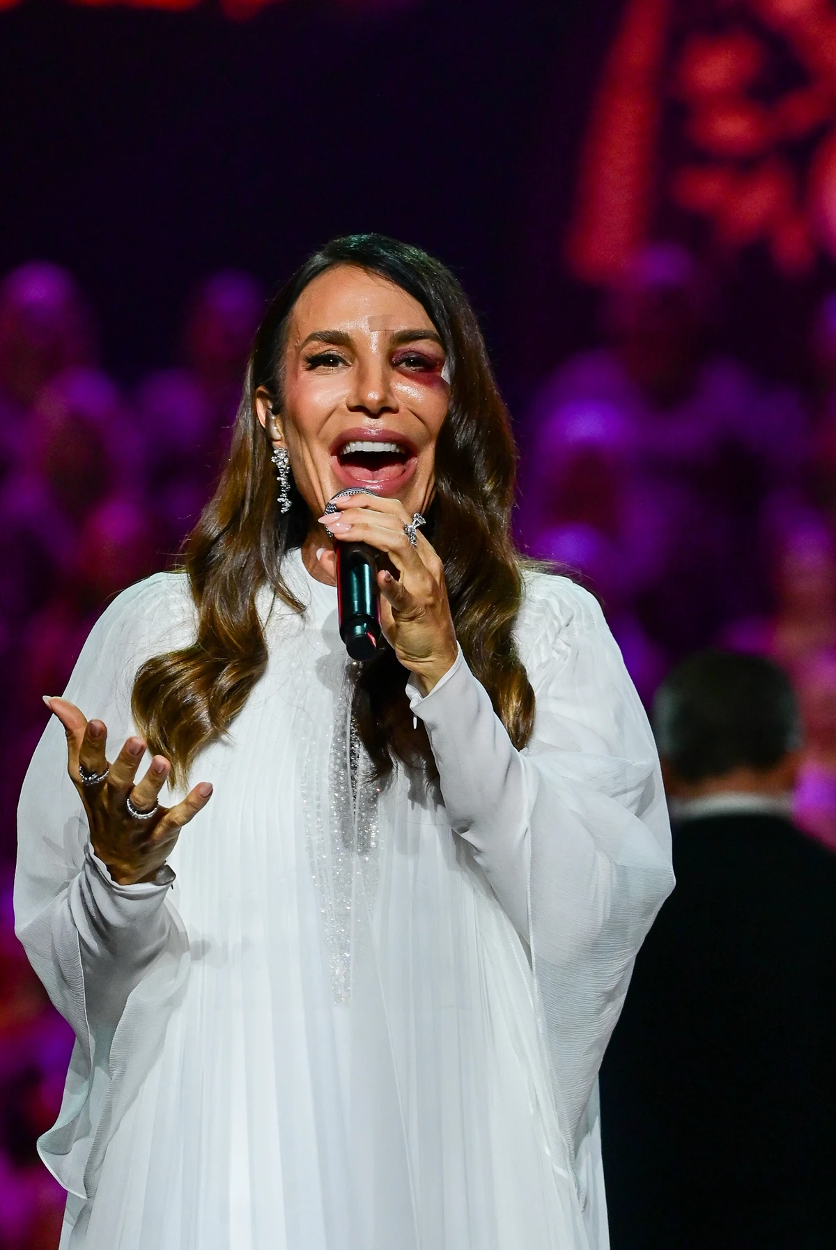 Ivete Sangalo faz primeiro show após acidente doméstico por Léo Franco/AgNews