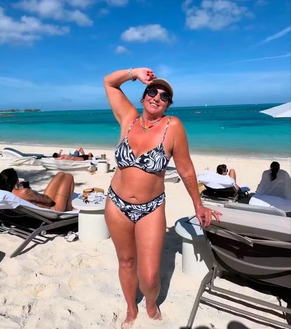 Margareth Serrão antes da cirurgia plástica por Reprodução/Instagram