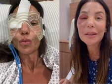 Imagem - Ivete Sangalo aparece com máscara de gelo e atualiza fãs após cirurgia no rosto