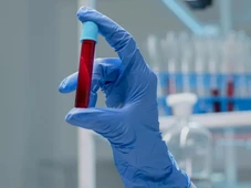 Imagem - Testemunhas de Jeová mudam regra polêmica sobre doar sangue