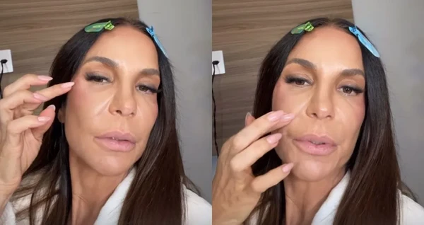 Ivete Sangalo após operar o rosto por Reprodução