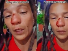 Imagem - Ambulante denuncia agressão de turistas israelenses em Itacaré: 'Jogou o celular na minha cara'