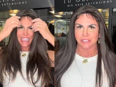 Imagem - Em tratamento contra alopecia, Gretchen exibe novo visual com peruca