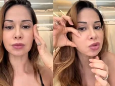 Imagem - Maíra Cardi revela que passará por cirurgia para 'abrir a cara inteira' após deformação no rosto: 'Gravíssimo'