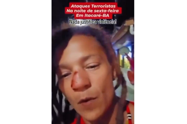 Ambulante denunciou agressão e mostrou nariz fraturado por Reprodução