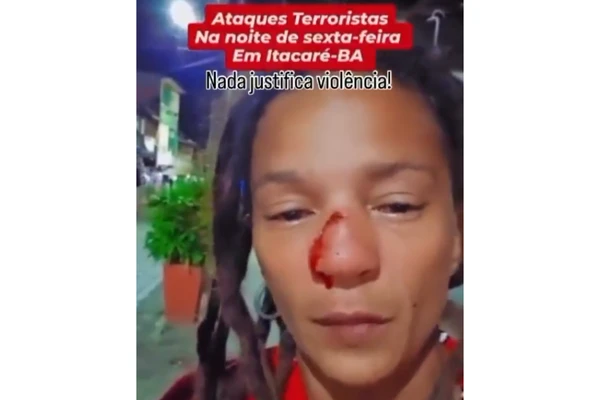 Ambulante denunciou agressão e mostrou nariz fraturado por Reprodução