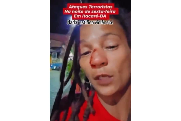 Ambulante denunciou agressão e mostrou nariz fraturado por Reprodução