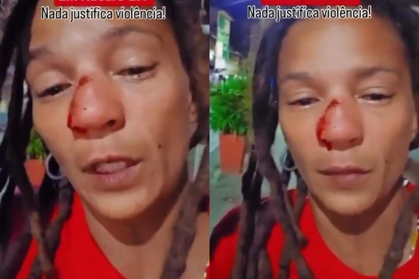 Ambulante denunciou agressão e mostrou nariz fraturado